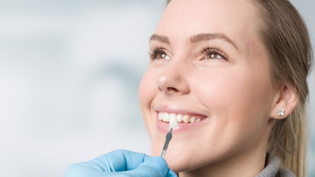 Was sind Veneers Haltbarkeit und Vor- und Nachteile von Veneers