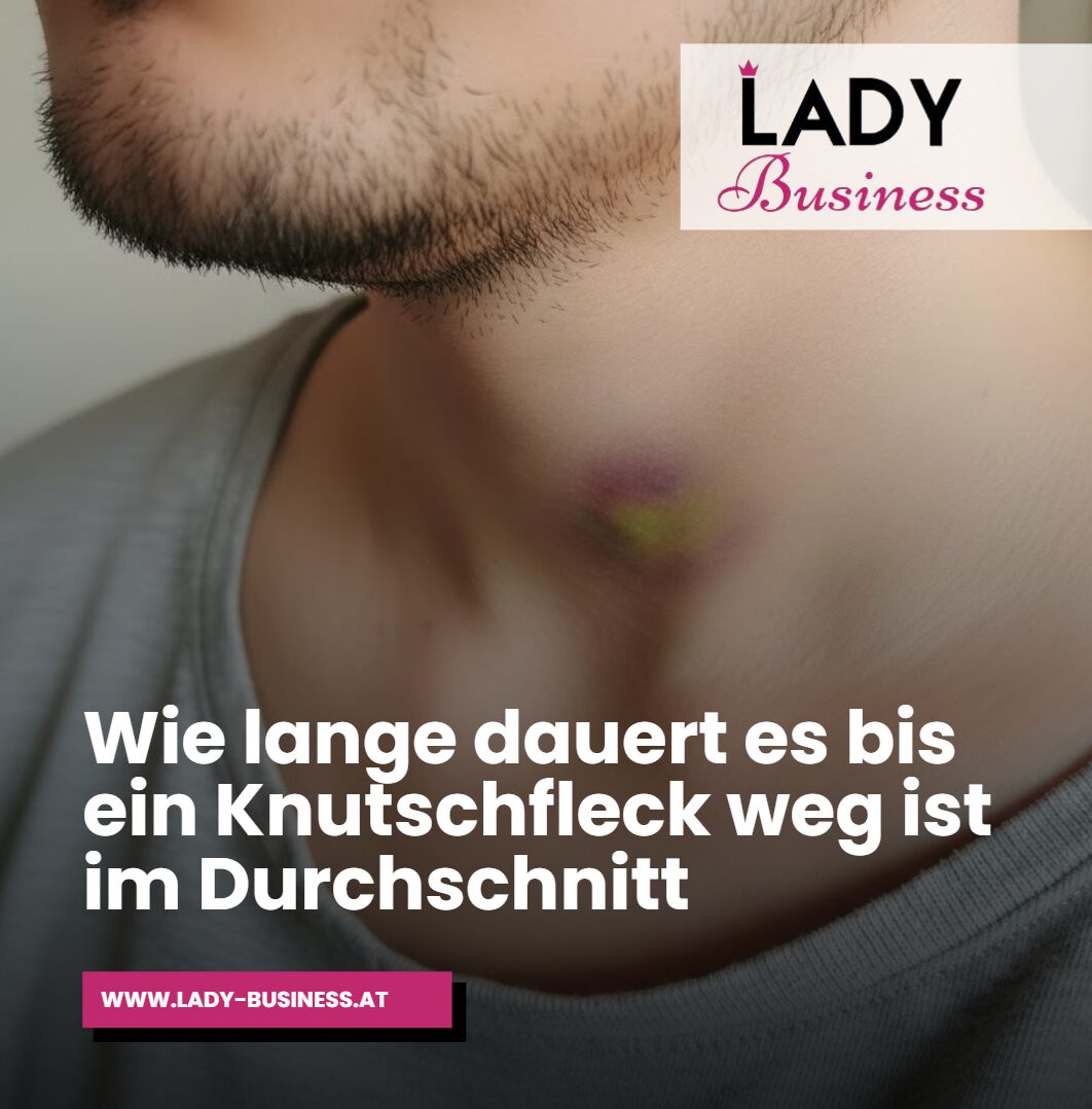 Wie lange dauert es bis ein Knutschfleck weg ist im Durchschnitt Wie lange dauert es bis ein Knutschfleck weg ist im Durchschnitt