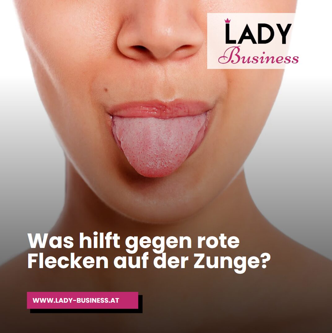 Was hilft gegen rote Flecken auf der Zunge?