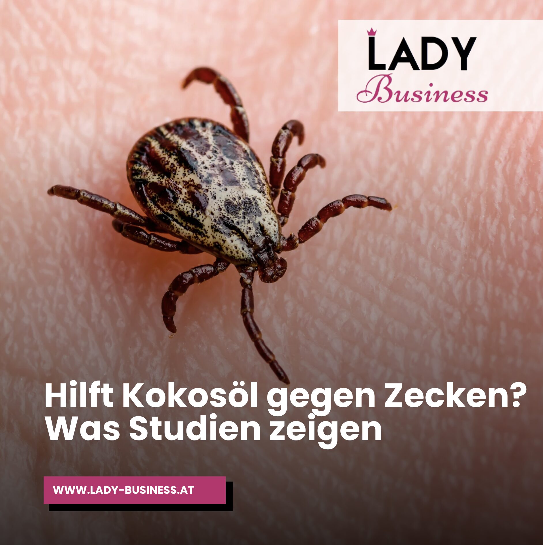 Hilft Kokosöl gegen Zecken? Was Studien zeigen Hilft Kokosöl gegen Zecken? Was Studien zeigen